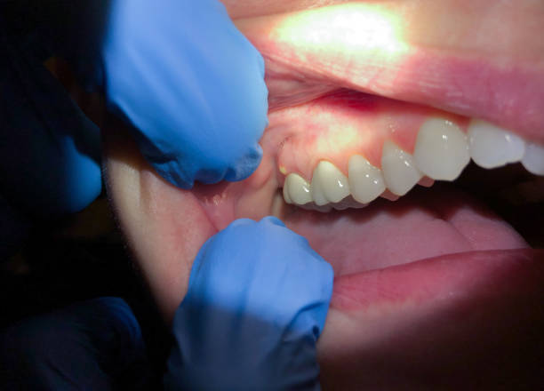 Best Emergency Dental Services for Seniors in Bainbridge, OH